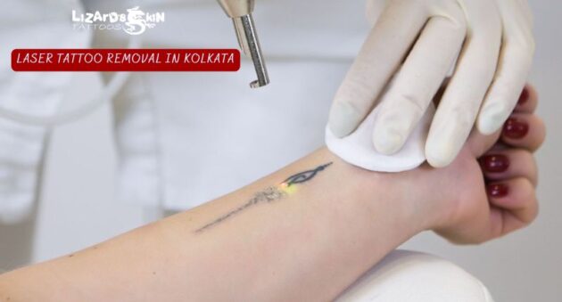 Kolkata Tattoo Removal: Essential Summer Aftercare