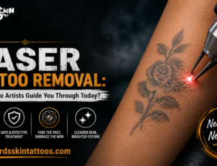tattoo removal in Kolkata