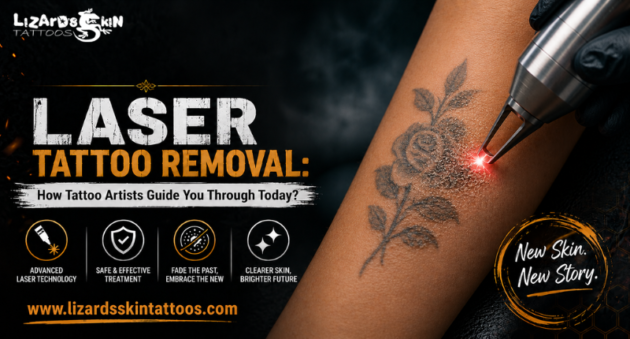 tattoo removal in Kolkata