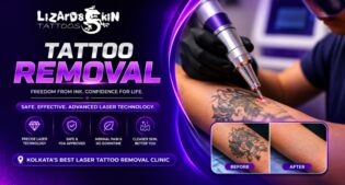Find the Best Tattoo Removal Clinic in Kolkata Today