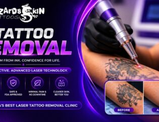 Find the Best Tattoo Removal Clinic in Kolkata Today