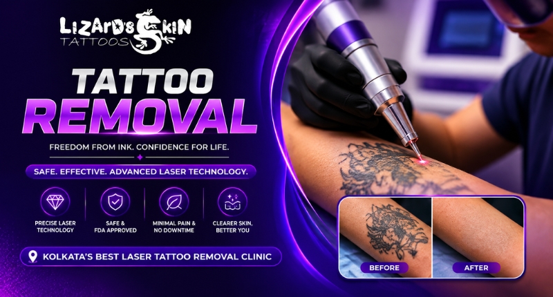 Find the Best Tattoo Removal Clinic in Kolkata Today