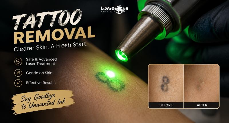 Safe Laser Treatment