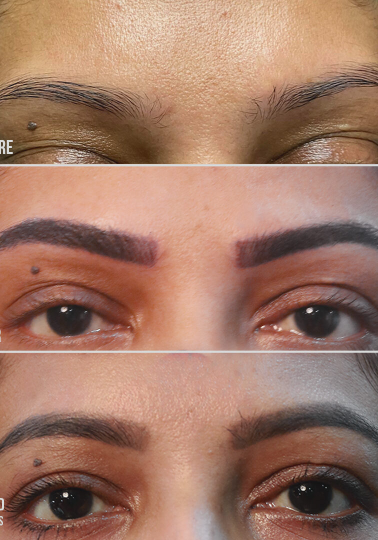 PERMANENT EYEBROWS